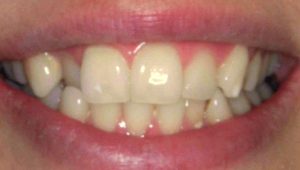 , Smile Gallery