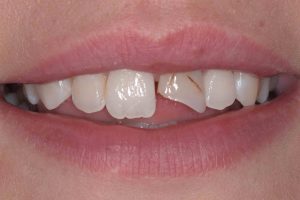, Smile Gallery